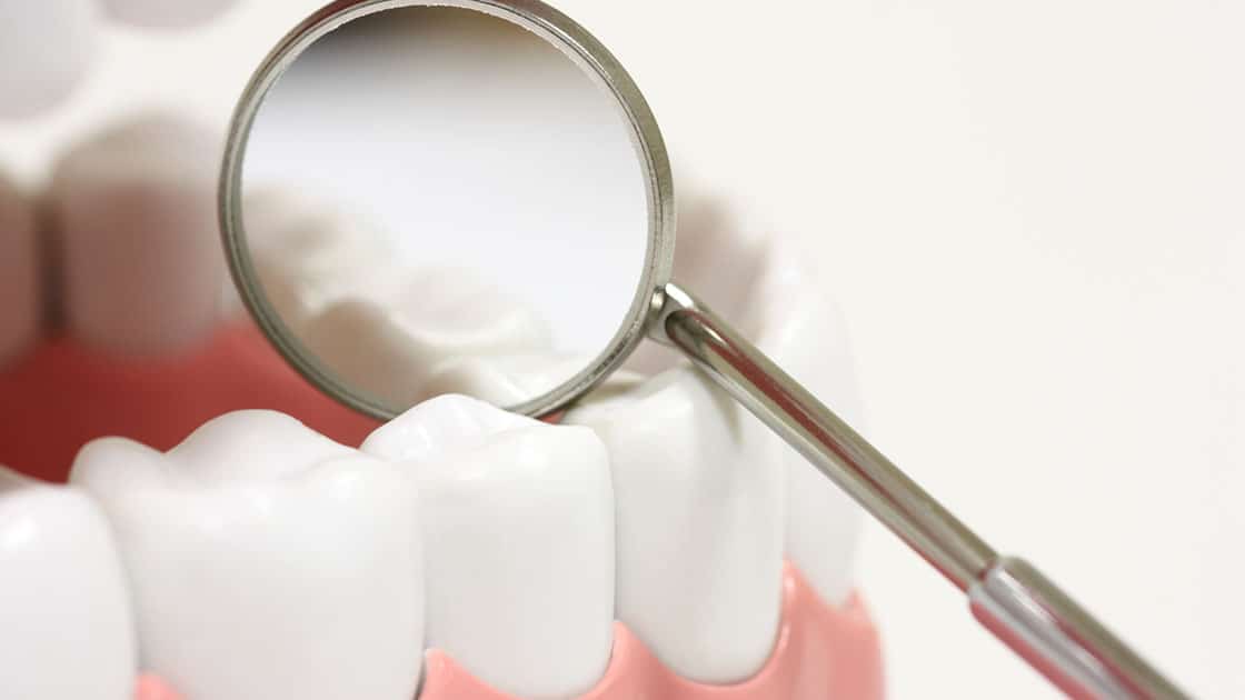 White Teeth with Dental Mirror